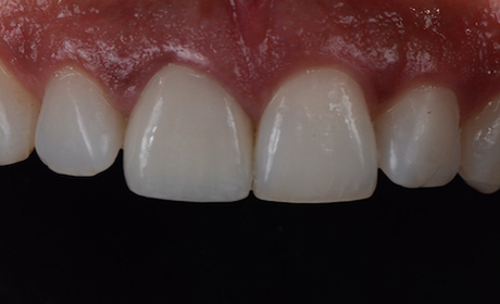 AA-Case-10-Before