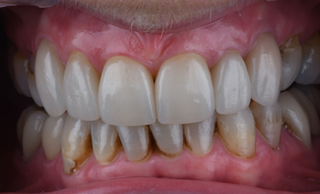 AA-Case-3-After