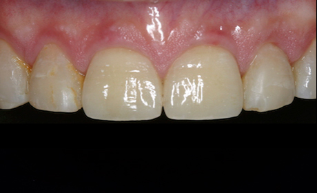 AA-Case-7-After