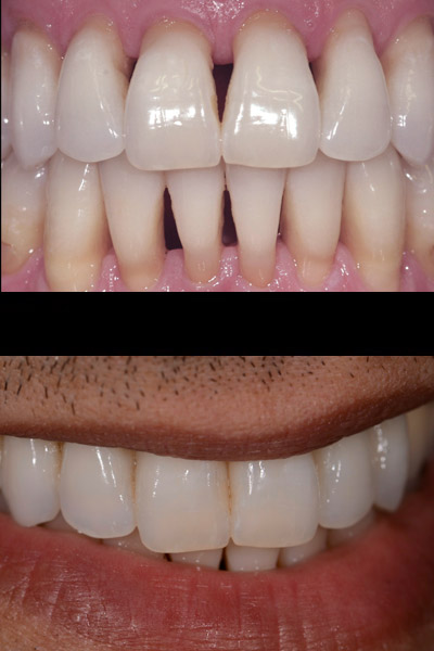 smile-05-bna-full