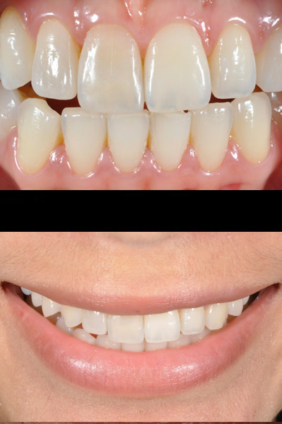smile-06-bna-full