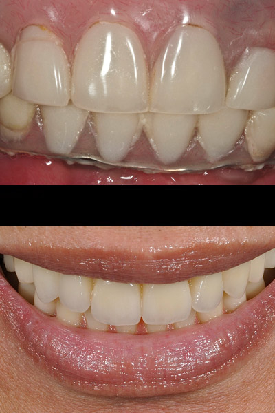 smile-07-bna-full