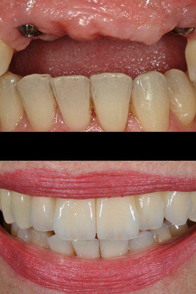 smile-08-bna-full