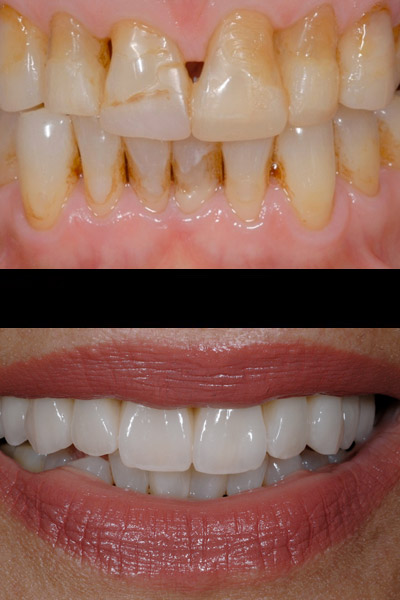 smile-09-bna-full