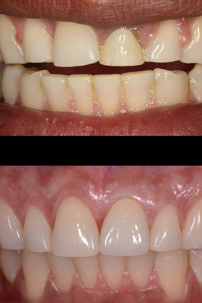 smile-10-bna-full