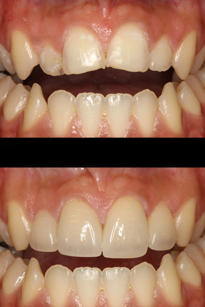 smile-12-bna-full