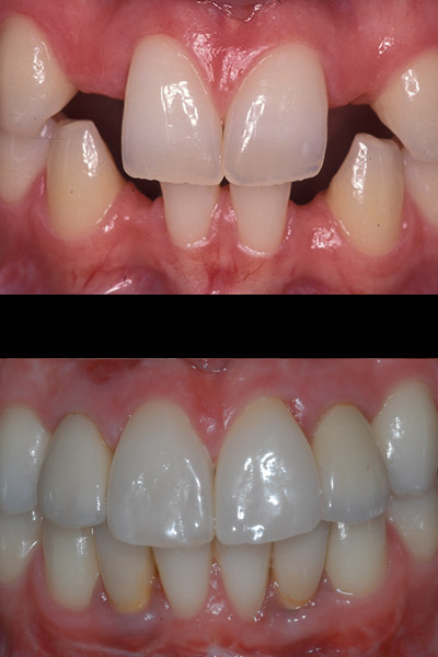 smile-16-bna-full