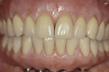 smile-22-after
