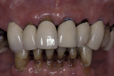 smile-22-before